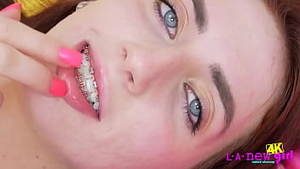 Beautiful 4K video of Teen with Braces Thumb